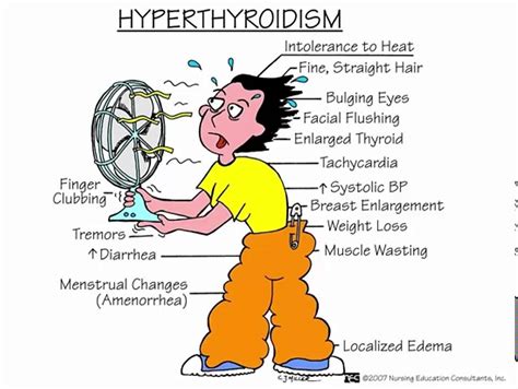Hyperthyroidism - YouTube