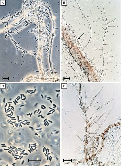 Phaeoacremonium Rubrigenum Strain Ak 19398 A B Synnemata