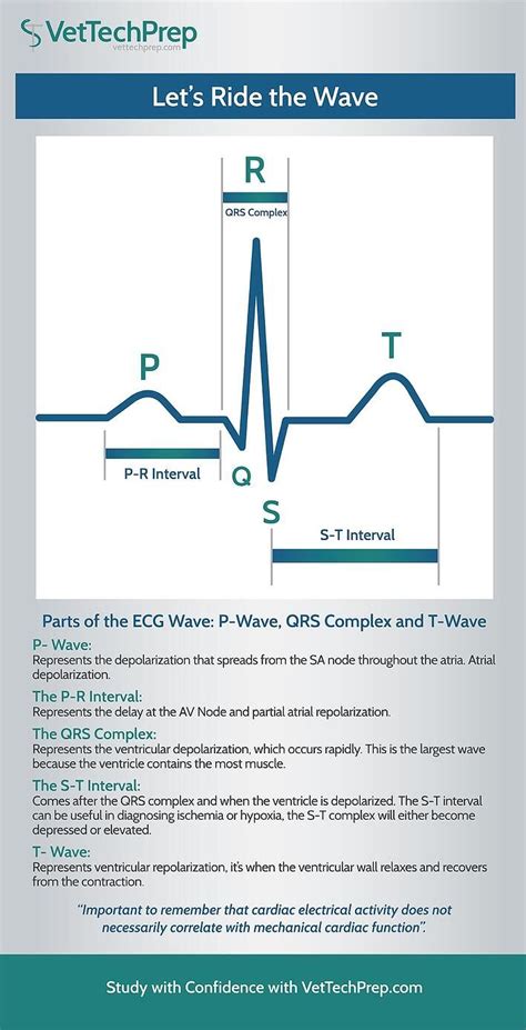infographic parts   ecg wave artofit