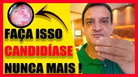 Homem Antes E Depois Da Candidíase - Candidíase Masculina: Saiba o que é,Tratamento Caseiro Para Candidíase ...