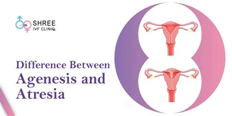 Atresia Of Vagina Causes Symptoms Diagnosis And Treatment JiangRuoan