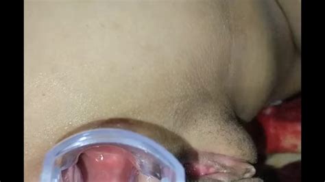 Especulo Anal Pornhub
