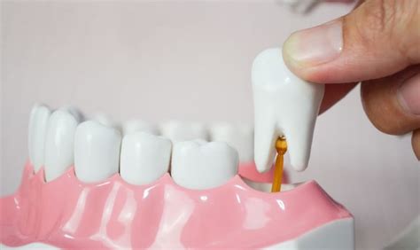 How Removing Your Wisdom Teeth Can Improve Overall Wellness