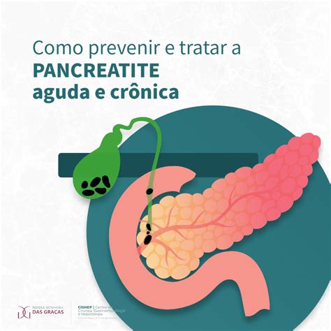 Como Tratar A Pancreatite