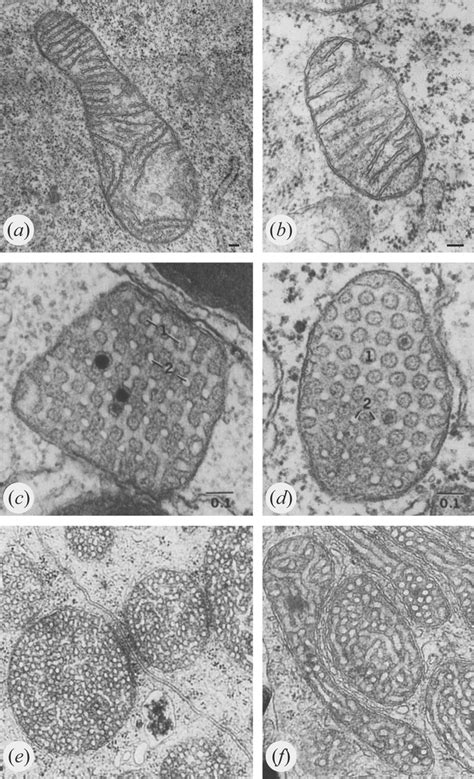 Mitochondrial cristae have varied morphologies. (a,b) Mouse embryonic ...