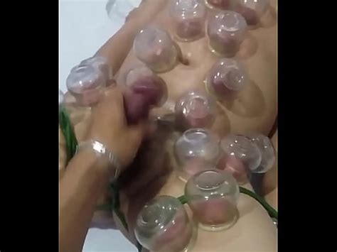 Giác hơi bao dâm XVIDEOS