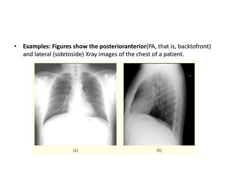 Ppt X Ray And Computed Tomography Ct Powerpoint Presentation Id6541198