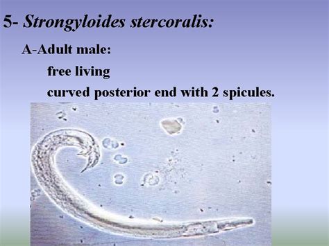 Lab 5 Strongyloides stercoralis Threadworm Trichinella spiralis The