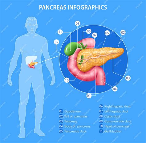 Infográficos realistas de anatomia do pâncreas com silhueta do corpo ...
