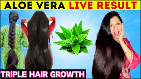 This👆🏼Aloe vera Trick-Turned My Bald Hair to Thick Heavy Hair- 30 Days ...