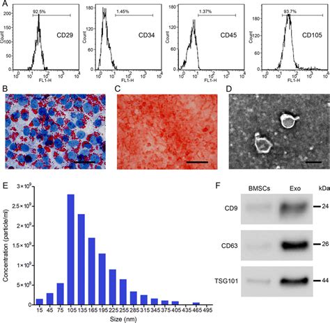 Identification And Isolation Of Bone Marrow Mesenchymal Stem Cell