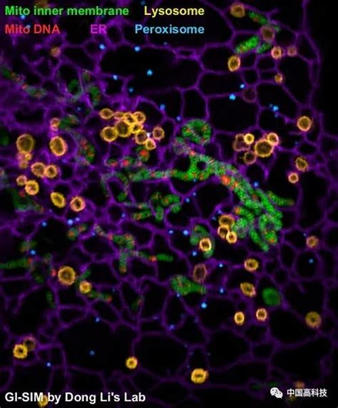 前沿科技 中科院等科学家合作开发新型超分辨成像技术研究揭示细胞器互作新现象内质网