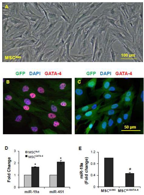 Figure From Exosomes Secreted From Gata Overexpressing Mesenchymal