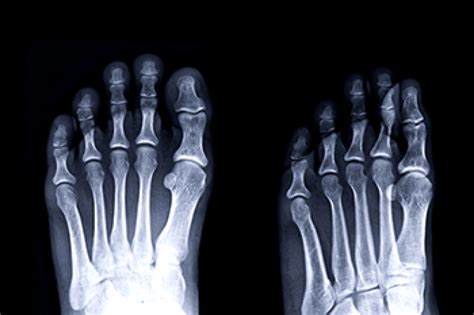 How Does The Cuboid Bone Work