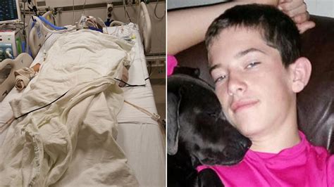 Texas Teen May Be Blinded After Fireworks Accident 6abc Philadelphia