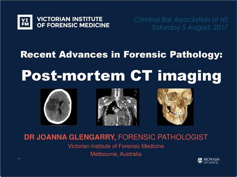 Recent Advances In Forensic Pathology Post Mortem CT Imaging Ppt