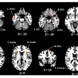 Resting State Brain Activity Alterations In Chronic Tinnitus Patients