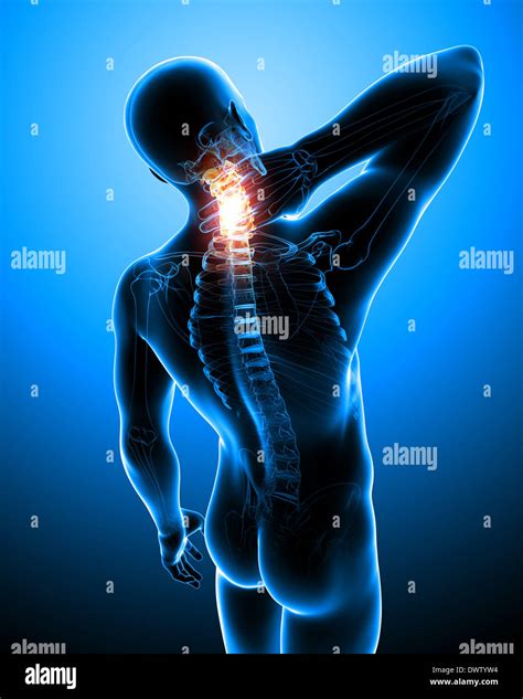 Cervical vertebra pain drawing Stock Photo - Alamy