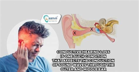 Understanding Conductive Hearing Loss Causes And Characteristics Aanvii Hearing