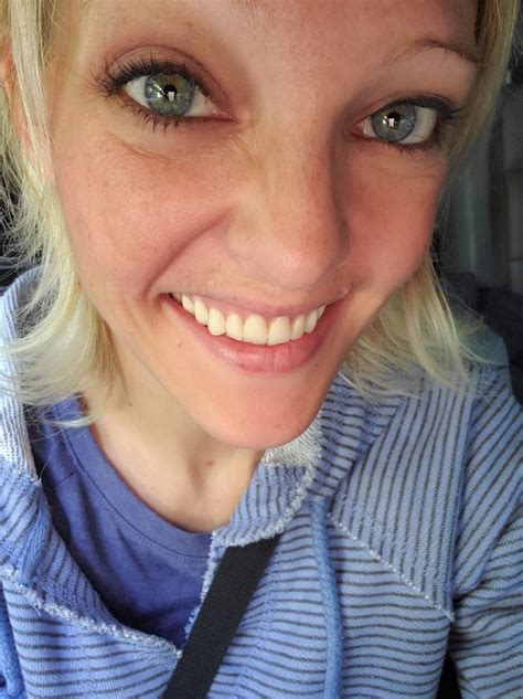 The women of DentureTok are fighting stigma — and creepy fetishists