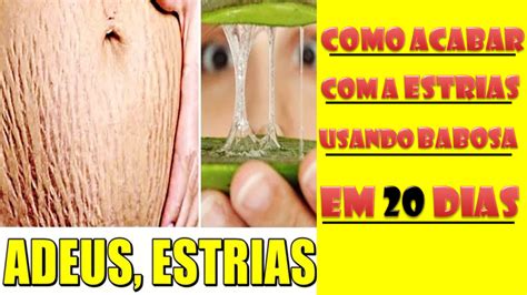Babosa Na Pele Antes E Depois - Babosa Estrias Antes E Depois - RETOEDU