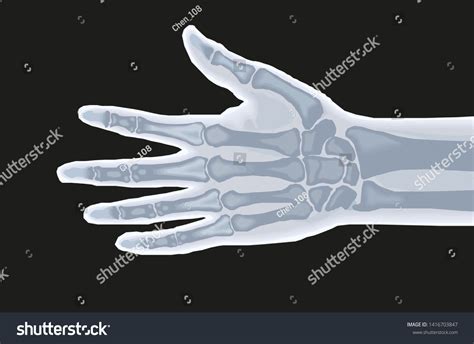 Human Hand Bones X Ray Anatomy Stock Vector (Royalty Free) 1416703847 ...