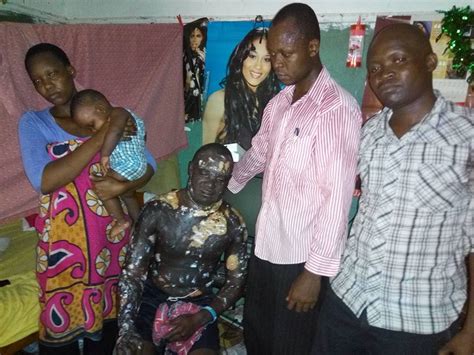 Kenyan Woman Burns Her Husband With Hot Oil On Christmas Day Graphic Photos Crime Nigeria