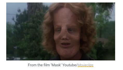 The incredible life of Rocky Dennis - the boy whose rare deformity ...