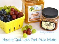 The Acne Roadmap: From Popped To Perfect In No Time