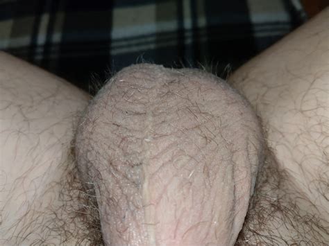 Flaccid Cock Banded Nude Pics Xhamster