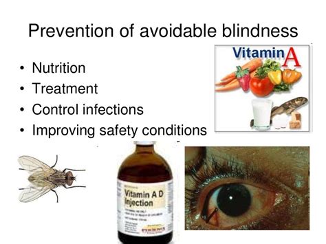 Causes Of Blindness