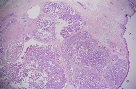 Hematoxylin And Eosin Stain 20x Magnification This Low Power Image