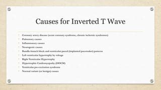 ECG-T wave inversion , Dr. Malala Rajapaksha ,Cardiology unit,General ...