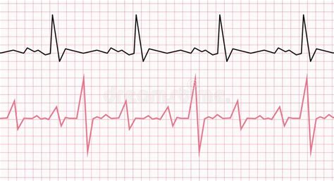 Cardiogram On A Graph Paper Heartbeat Line Vector Illustration Stock