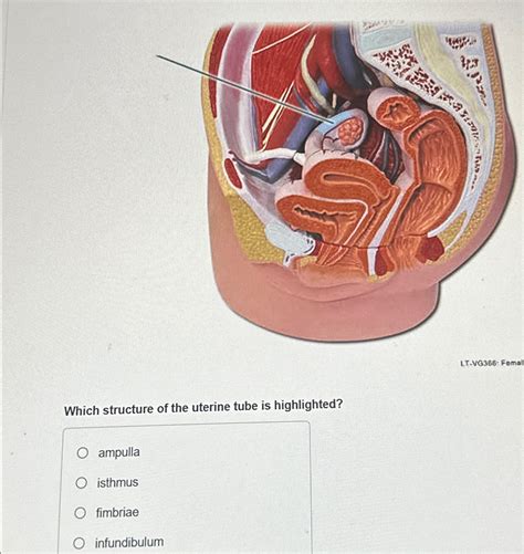 Solved Which Structure Of The Uterine Tube Is Chegg