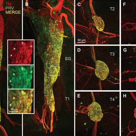 Quantitative distribution of sympathetic postganglionic neurons ...