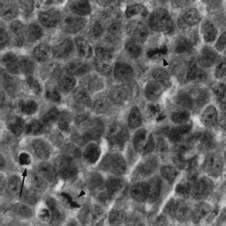 Xenograft Development In Nude Mice In Response To The Injection Of NCI