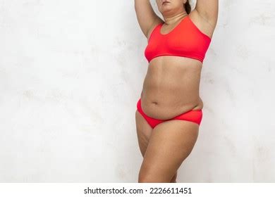 Naked Overweight Woman Bending Over Massage Stock Photo Shutterstock