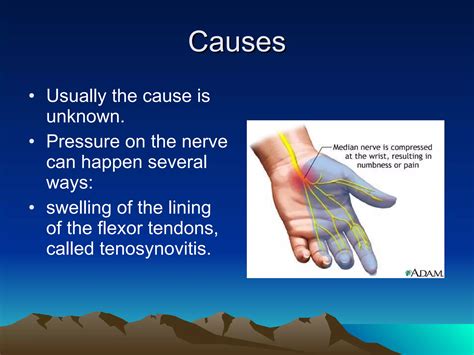 Carpal tunnel syndrome | PPT | Free Download