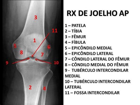 Radiologia On Instagram 11 Pontos Importantes Para Tomar Nota E