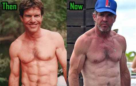 Dennis Quaid Plastic Surgery Botox And Eye Lift Before After Photos