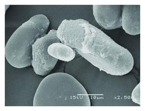 SEM Micrographs Of Granules Of Banana Starch Native Starch A