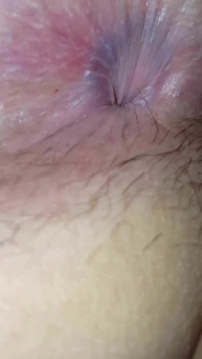 Spreading Wifes Hairy Ass And Hairy Pussy Anal Porn Xhamster