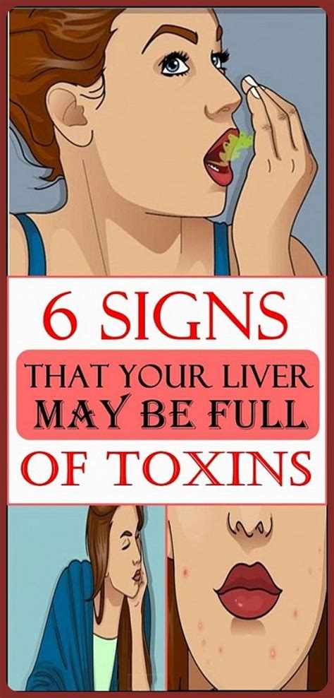 6 Signs That Your Liver Is Full Of Toxins Wellness Days