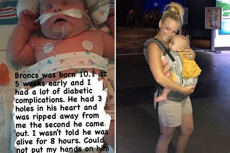 Teen Mom Mackenzie Mckee Reveals Son Broncs 5 Was Born With Three