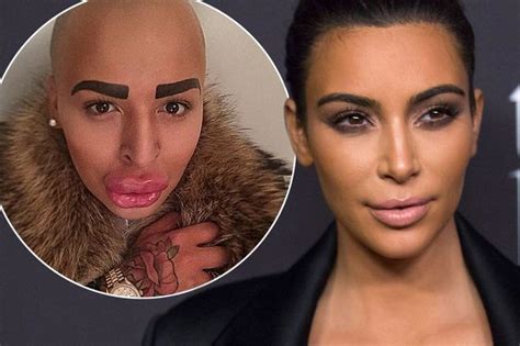 Kim Kardashian Wannabe Jordan James Parke Refused More Surgery On New