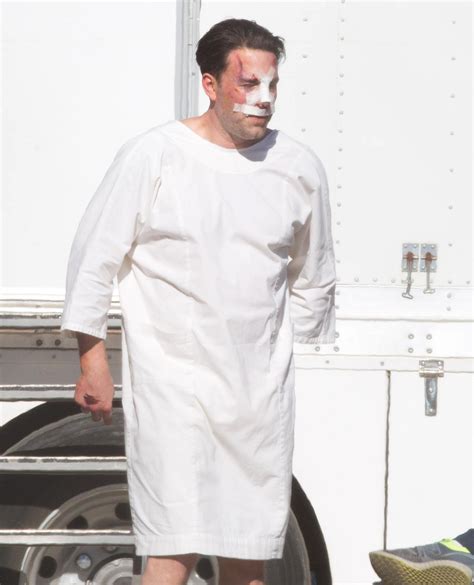 Ben Affleck Fuels Plastic Surgery Rumors