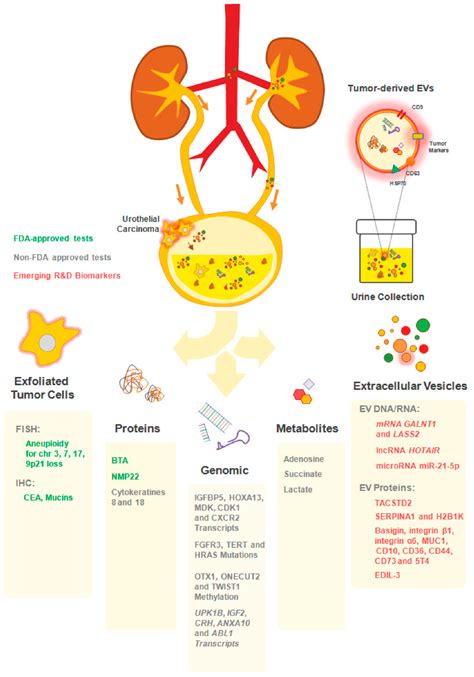 Cartoon Bladder Cancer Nintedanib: A New Player In Bladder Cancer?
