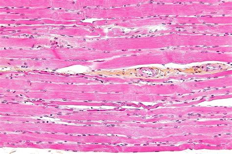 Tecidos Muscular Estriado Esquelético