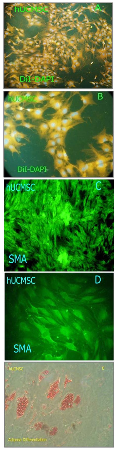 Characterization Of Human Umbilical Cord Matrix Cells Hucmsc Cells Download Scientific